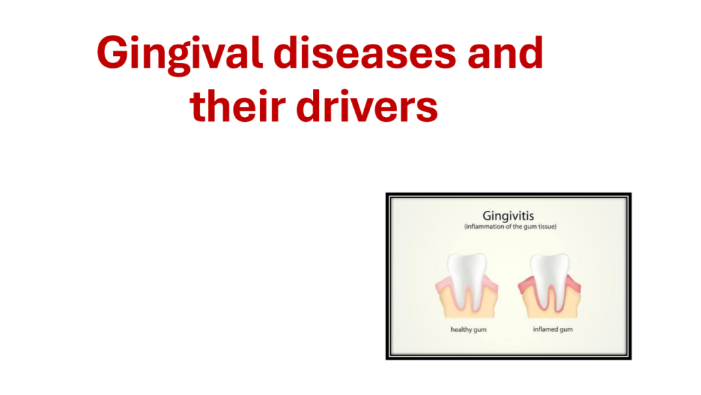 Gingival diseases dental examination